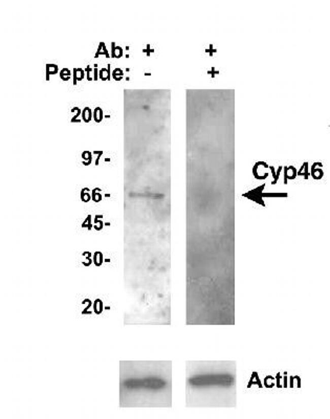 CYP46A1 Antibody in Western Blot (WB)