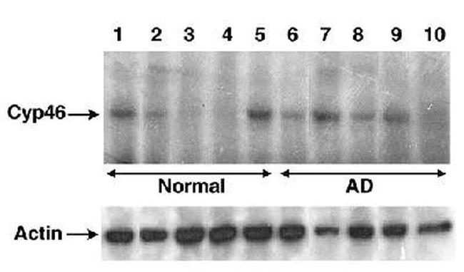 CYP46A1 Antibody in Western Blot (WB)