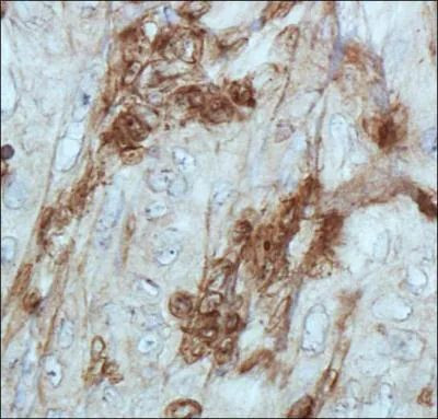 Cathepsin E Antibody in Immunohistochemistry (Paraffin) (IHC (P))