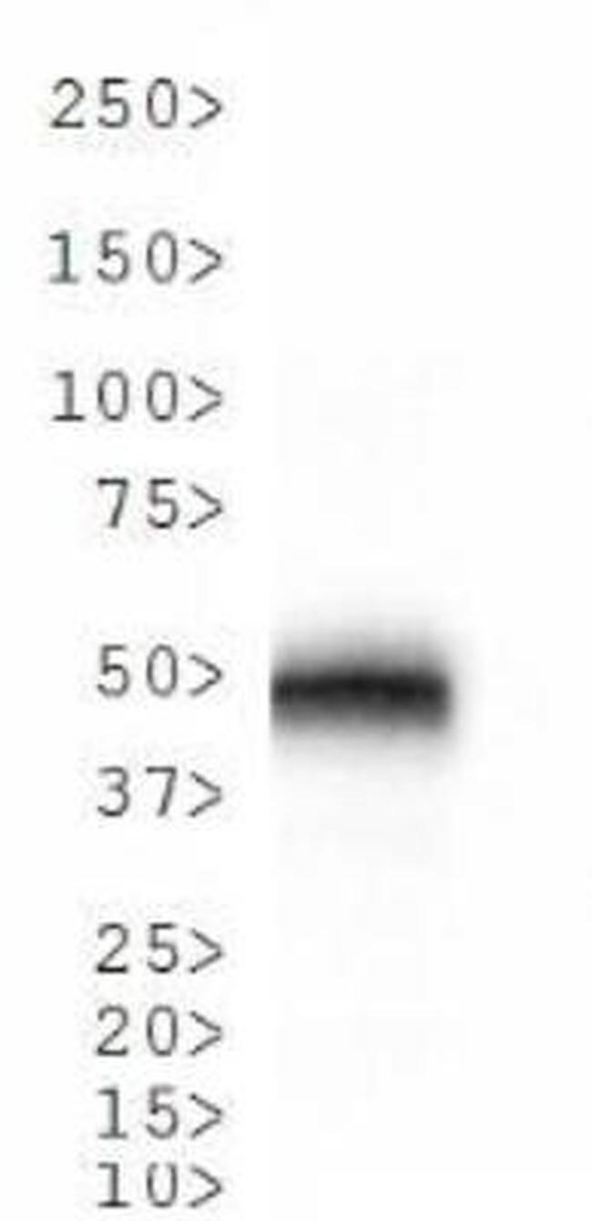 Cathepsin E Antibody in Western Blot (WB)