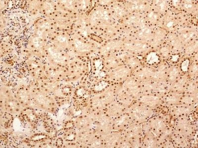 NuMA Antibody in Immunohistochemistry (Paraffin) (IHC (P))