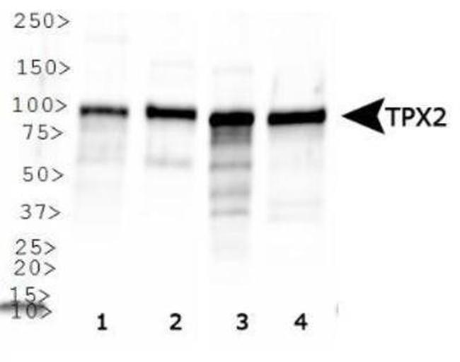 TPX2 Antibody in Western Blot (WB)