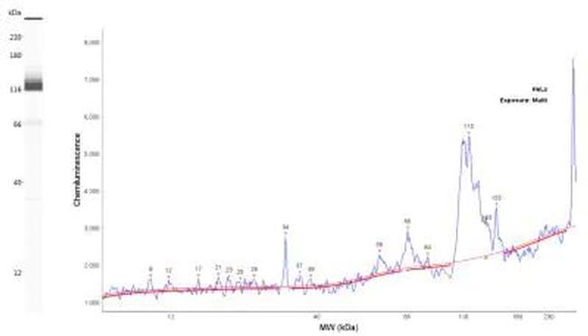 TPX2 Antibody in Western Blot (WB)