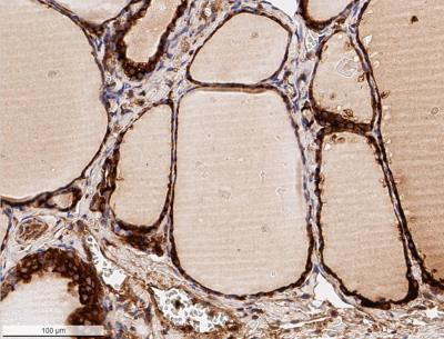 Calreticulin Antibody in Immunohistochemistry (Paraffin) (IHC (P))