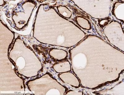 Calreticulin Antibody in Immunohistochemistry (Paraffin) (IHC (P))