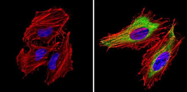 CXCR4 Antibody in Immunocytochemistry (ICC/IF)