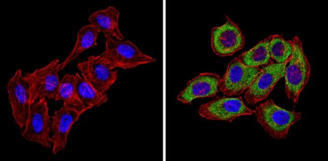 CXCR4 Antibody in Immunocytochemistry (ICC/IF)