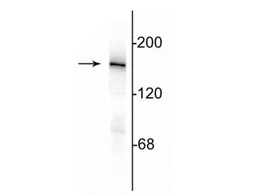 NMDAR2A Antibody in Western Blot (WB)