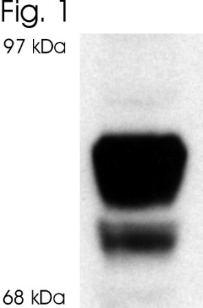 Glucocorticoid Receptor beta Antibody in Western Blot (WB)