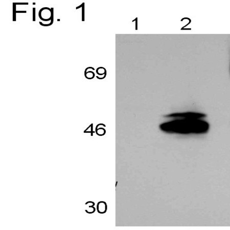 RAR gamma-1 Antibody in Western Blot (WB)