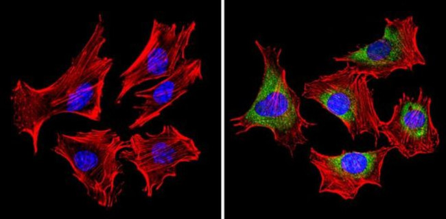 mDIC Antibody in Immunocytochemistry (ICC/IF)