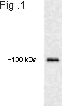 E6AP Antibody in Western Blot (WB)