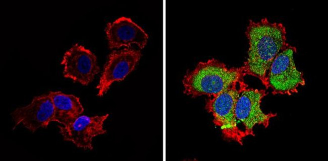 IGF2R Antibody in Immunocytochemistry (ICC/IF)