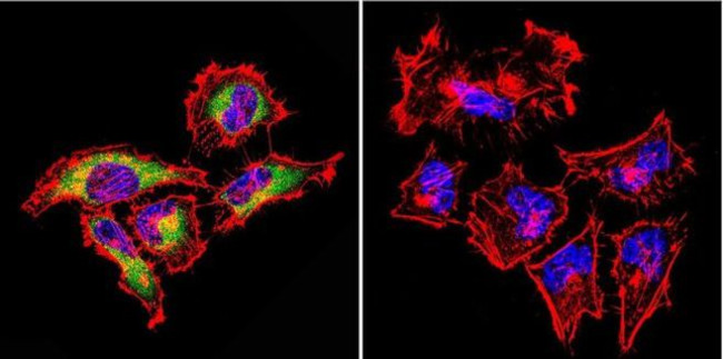 Rab4 Antibody in Immunocytochemistry (ICC/IF)