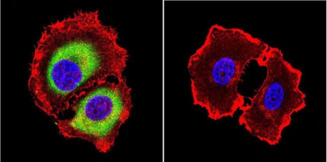 Rab4 Antibody in Immunocytochemistry (ICC/IF)