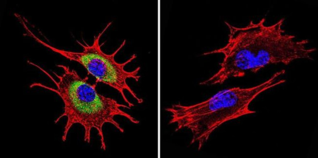 Rab4 Antibody in Immunocytochemistry (ICC/IF)