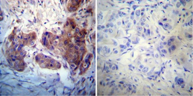 Rab4 Antibody in Immunohistochemistry (Paraffin) (IHC (P))