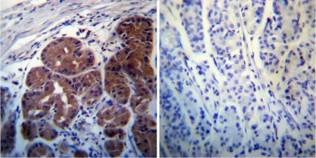 Rab4 Antibody in Immunohistochemistry (Paraffin) (IHC (P))