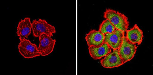 XPC Antibody in Immunocytochemistry (ICC/IF)