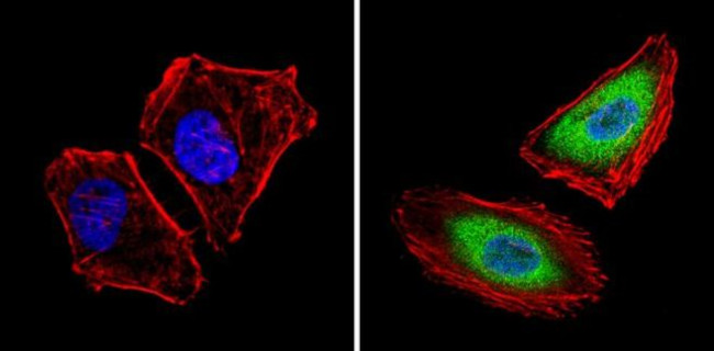 XPC Antibody in Immunocytochemistry (ICC/IF)