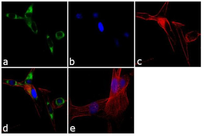 SEC61B Antibody in Immunocytochemistry (ICC/IF)