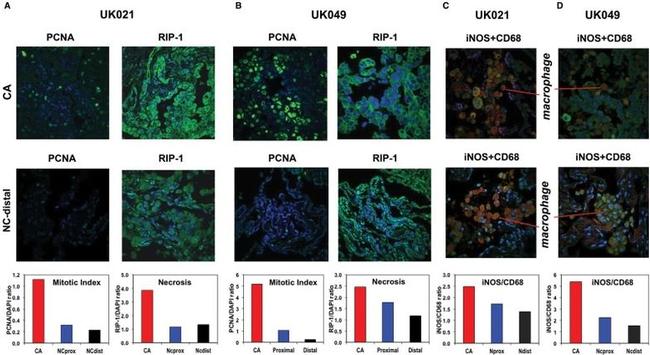 iNOS Antibody in Immunohistochemistry (Paraffin) (IHC (P))