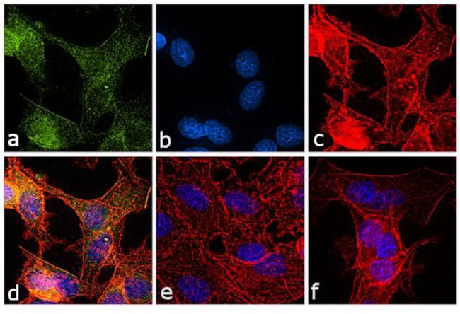 iNOS Antibody in Immunocytochemistry (ICC/IF)