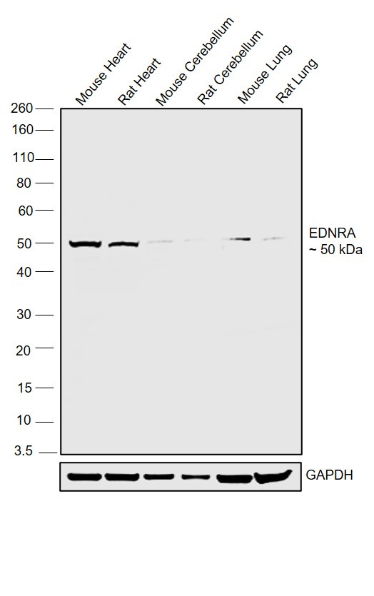 Endothelin A Receptor Antibody