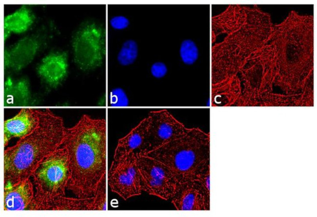 Endothelin 1 Antibody in Immunocytochemistry (ICC/IF)