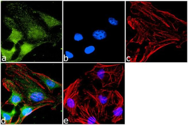 CXCR7 Antibody in Immunocytochemistry (ICC/IF)