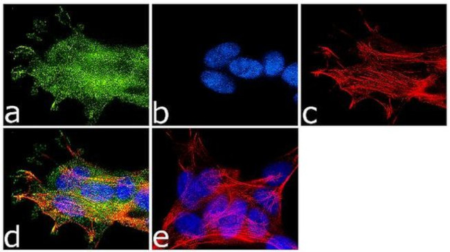 NMDAR1 Antibody in Immunocytochemistry (ICC/IF)