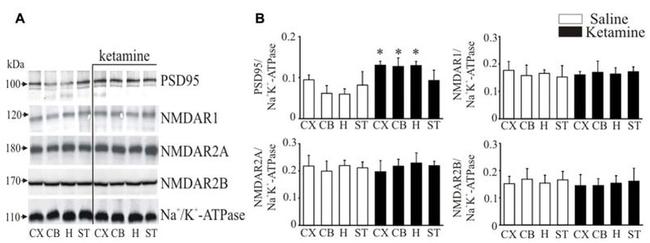 NMDAR2A Antibody in Western Blot (WB)