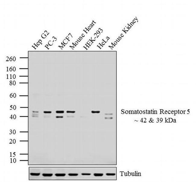 SSTR5 Antibody in Western Blot (WB)