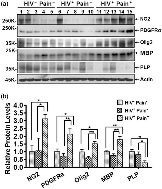 PLP1 Antibody in Western Blot (WB)