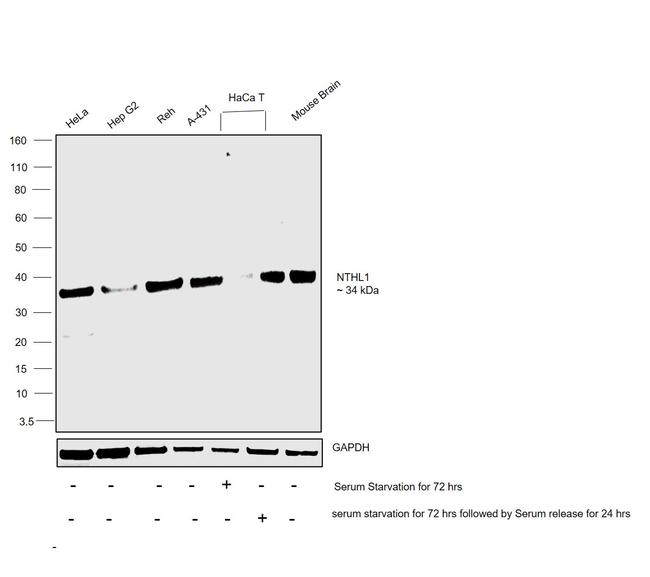 NTHL1 Antibody in Western Blot (WB)