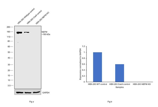 NEFM Antibody in Western Blot (WB)