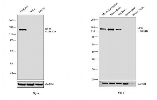 NEFM Antibody in Western Blot (WB)