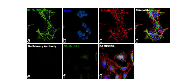 NEFM Antibody in Immunocytochemistry (ICC/IF)