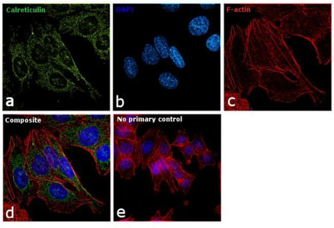 Calreticulin Antibody in Immunocytochemistry (ICC/IF)