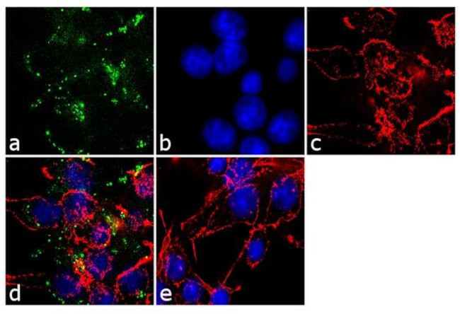 AGTR2 Antibody in Immunocytochemistry (ICC/IF)