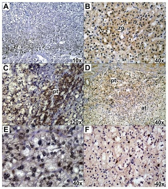 Glucocorticoid Receptor beta Antibody in Immunohistochemistry (IHC)