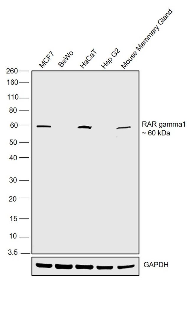 RAR gamma-1 Antibody in Western Blot (WB)