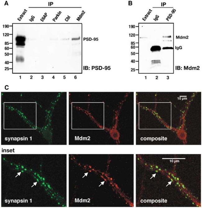 E6AP Antibody in Immunoprecipitation (IP)