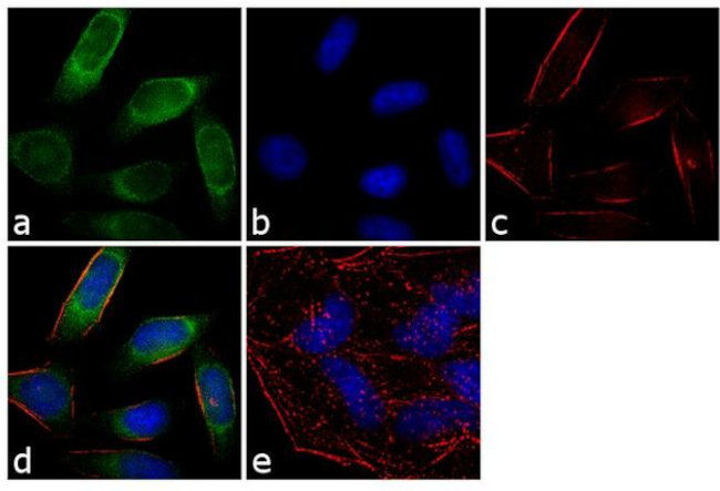 Rab4 Antibody in Immunocytochemistry (ICC/IF)