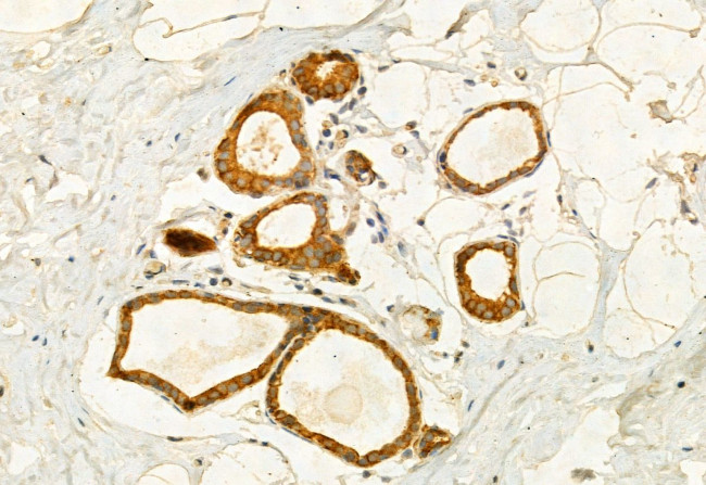 Kindlin 2 Antibody in Immunohistochemistry (Paraffin) (IHC (P))