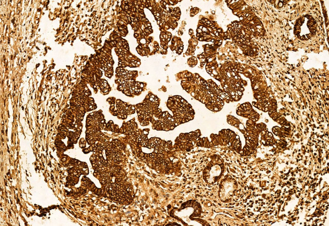 LGALS3BP Antibody in Immunohistochemistry (Paraffin) (IHC (P))