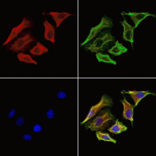 SKAP2 Antibody in Immunocytochemistry (ICC/IF)