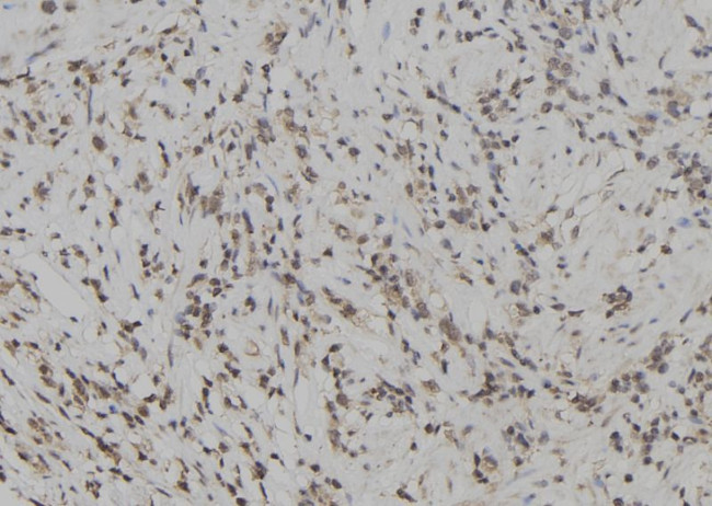 SKAP2 Antibody in Immunohistochemistry (Paraffin) (IHC (P))