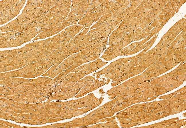 SKAP2 Antibody in Immunohistochemistry (Paraffin) (IHC (P))