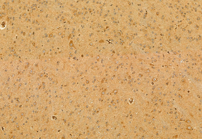 SKAP2 Antibody in Immunohistochemistry (Paraffin) (IHC (P))